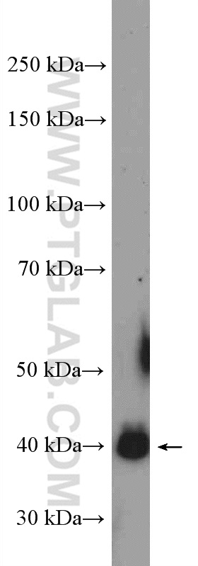 HepG2 cells were subjected to SDS PAGE followed by western blot with 26137-1-AP( C13orf33 Antibody) at dilution of 1:600