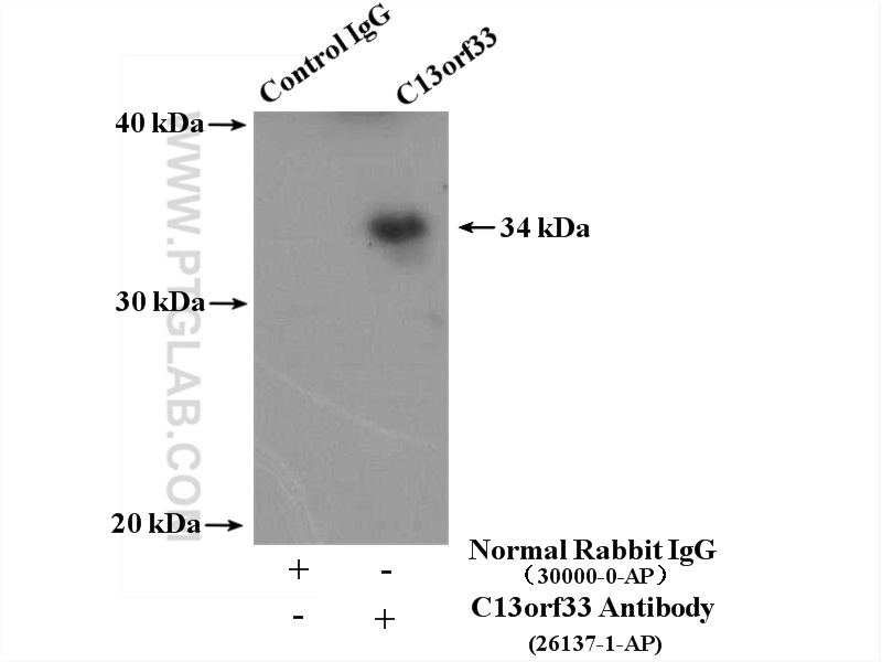 IP Result of anti-C13orf33 (IP:26137-1-AP, 4ug; Detection:26137-1-AP 1:300) with HepG2 cells lysate 4000ug.