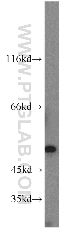 Jurkat cells were subjected to SDS PAGE followed by western blot with 22664-1-AP(C14orf39 antibody) at dilution of 1:1000