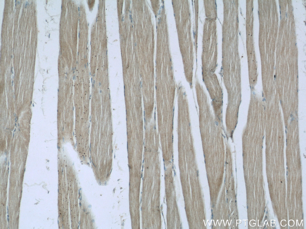 Immunohistochemistry of paraffin-embedded human skeletal muscle slide using 22664-1-AP( C14orf39 Antibody) at dilution of 1:50