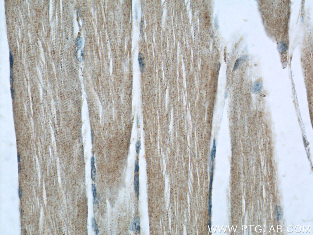 Immunohistochemistry of paraffin-embedded human skeletal muscle slide using 22664-1-AP( C14orf39 Antibody) at dilution of 1:50