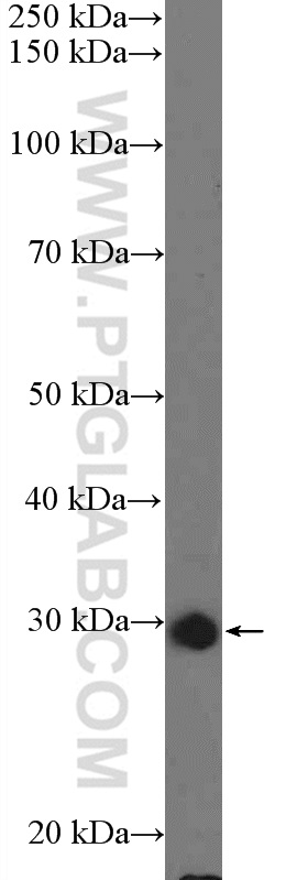 HepG2 cells were subjected to SDS PAGE followed by western blot with 26189-1-AP( C15orf23 Antibody) at dilution of 1:1500