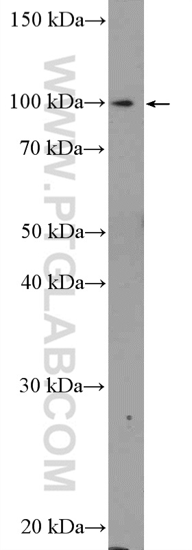 HEK-293 cells were subjected to SDS PAGE followed by western blot with 20126-1-AP( C15orf39 Antibody) at dilution of 1:600