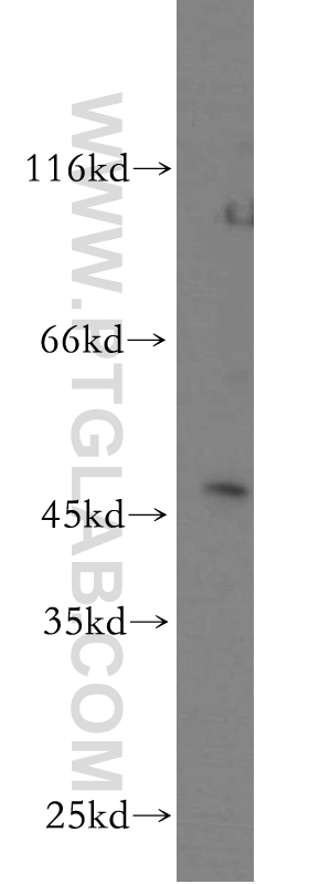 mouse brain tissue were subjected to SDS PAGE followed by western blot with 20602-1-AP(C16orf70 antibody) at dilution of 1:500