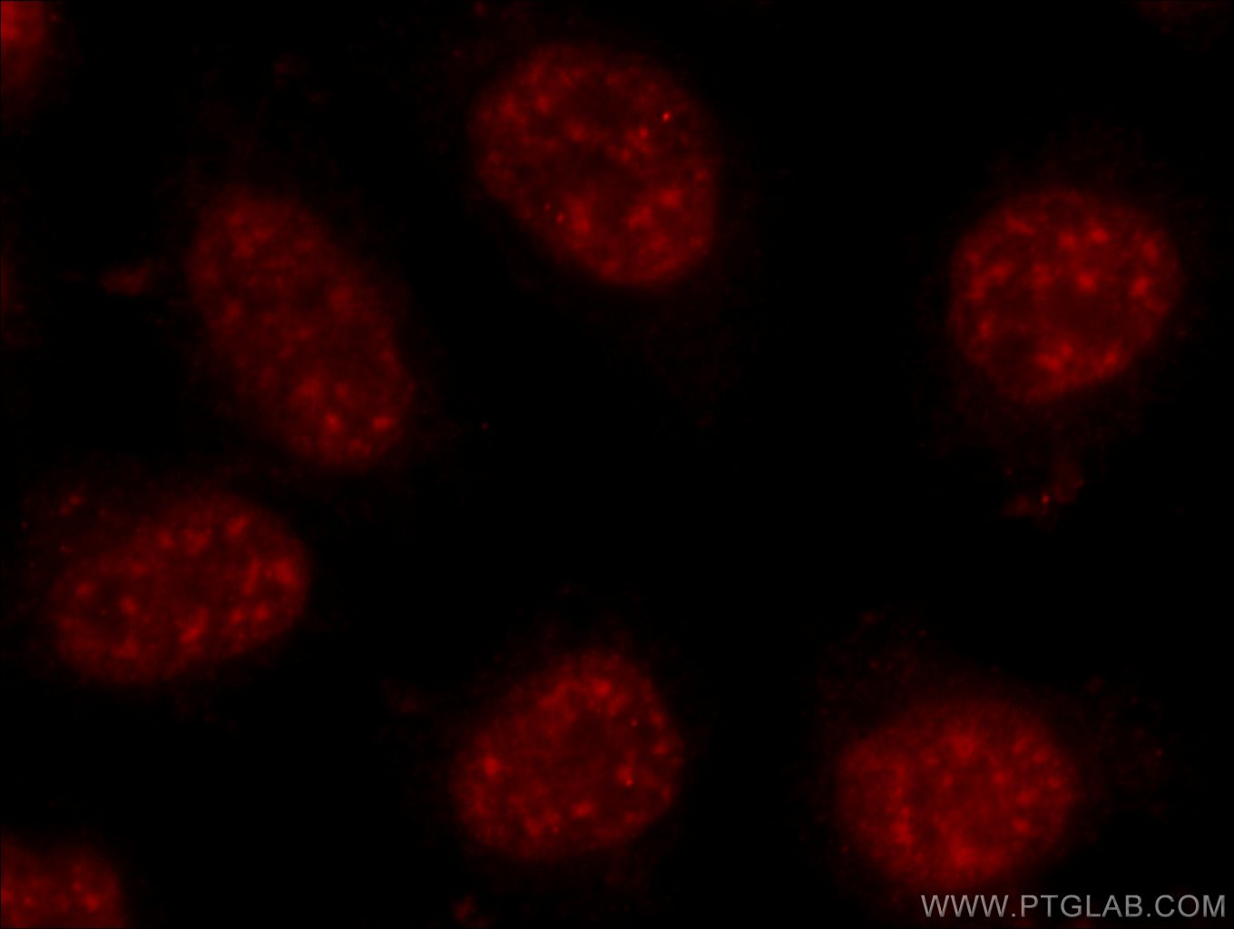 Immunofluorescent analysis of HeLa cells using 24384-1-AP( C17orf85 Antibody) at dilution of 1:25 and Rhodamine-Goat anti-Rabbit IgG