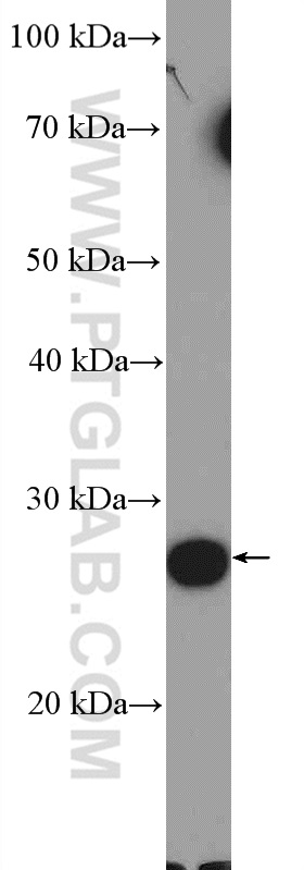human plasma tissue were subjected to SDS PAGE followed by western blot with 26113-1-AP( C19orf20 Antibody) at dilution of 1:600