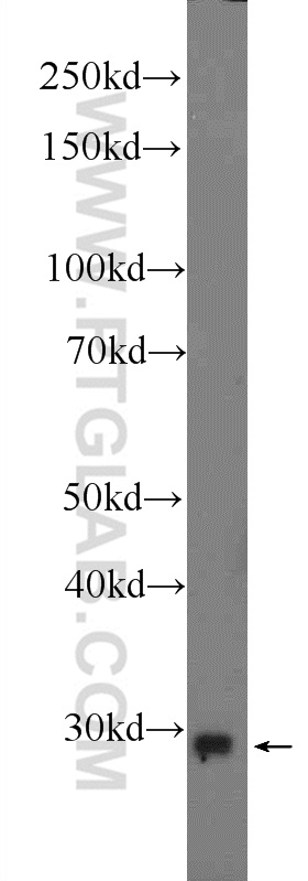 mouse skeletal muscle tissue were subjected to SDS PAGE followed by western blot with 25652-1-AP( C19orf52 Antibody) at dilution of 1:1000