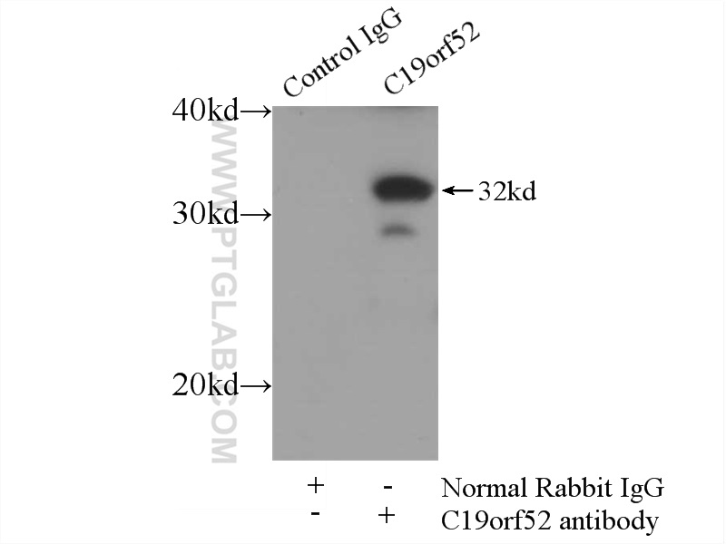 IP Result of anti-C19orf52 (IP:25652-1-AP, 3ug; Detection:25652-1-AP 1:700) with mouse skeletal muscle tissue lysate 4000ug.