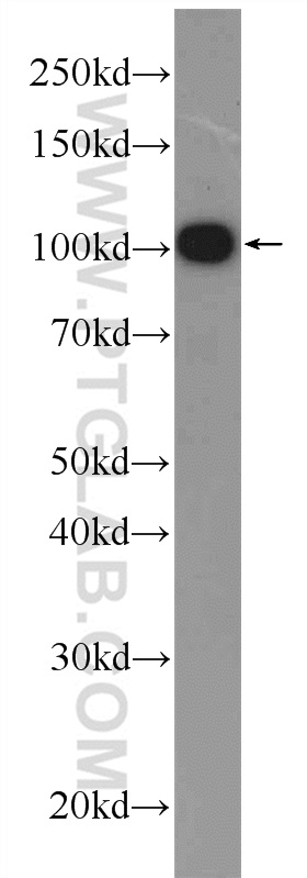 PC-3 cells were subjected to SDS PAGE followed by western blot with 25050-1-AP( C19orf57 Antibody) at dilution of 1:1000