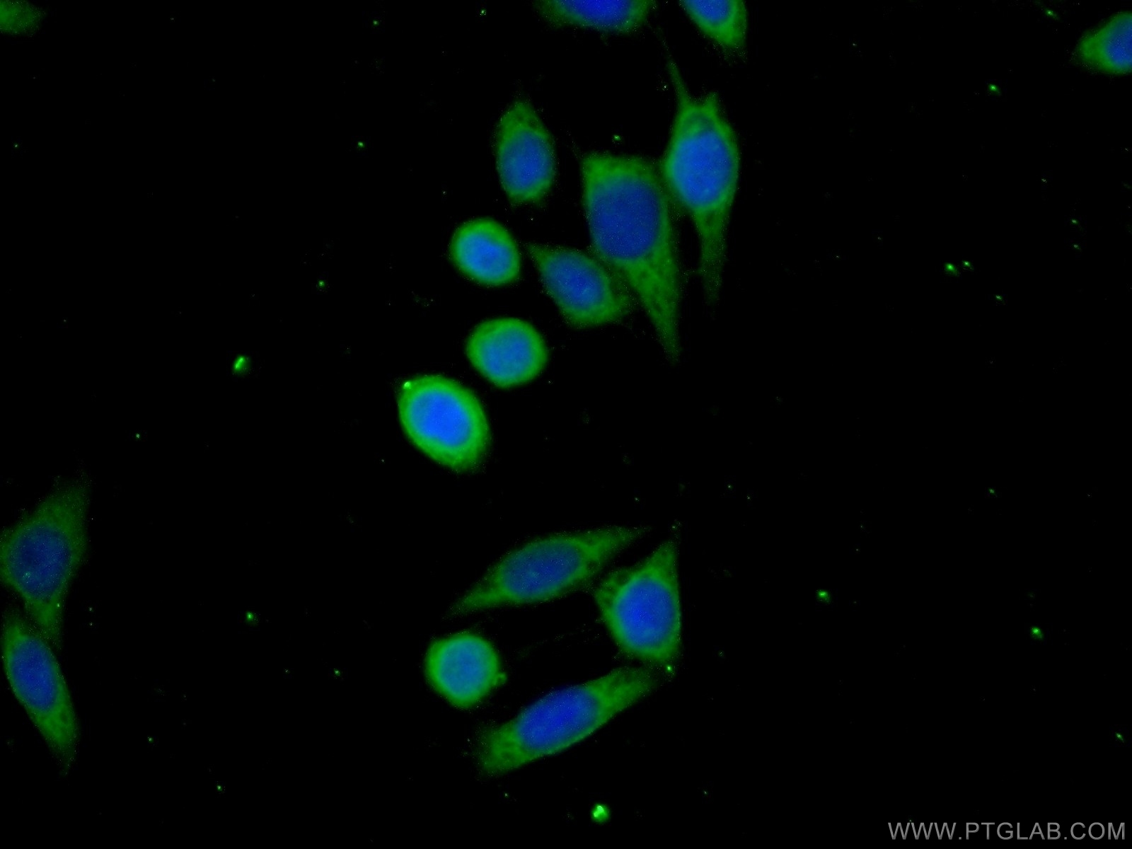 Immunofluorescent analysis of ( -20℃ Ethanol ) fixed PC-3 cells using 25050-1-AP( C19orf57 Antibody) at dilution of 1:50 and Alexa Fluor 488-congugated AffiniPure Goat Anti-Rabbit IgG(H+L)