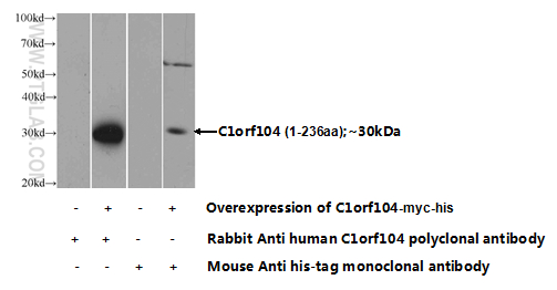 Transfected HEK-293 cells were subjected to SDS PAGE followed by western blot with 24360-1-AP( C1orf104 Antibody) at dilution of 1:1000