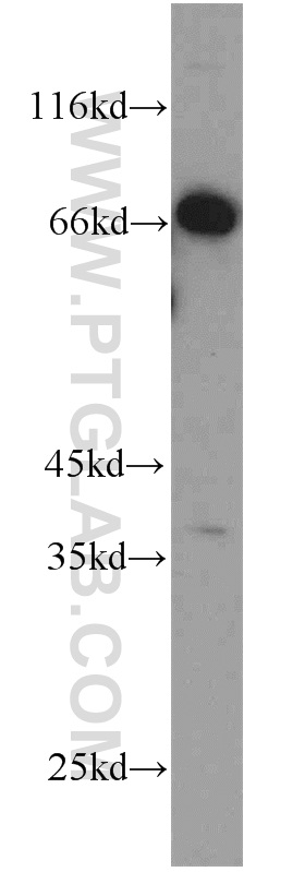 PC-3 cells were subjected to SDS PAGE followed by western blot with 14888-1-AP(C1orf116 antibody) at dilution of 1:800