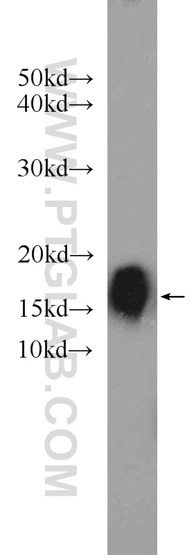 HEK-293 cells were subjected to SDS PAGE followed by western blot with 24209-1-AP(C1orf31 antibody) at dilution of 1:1000