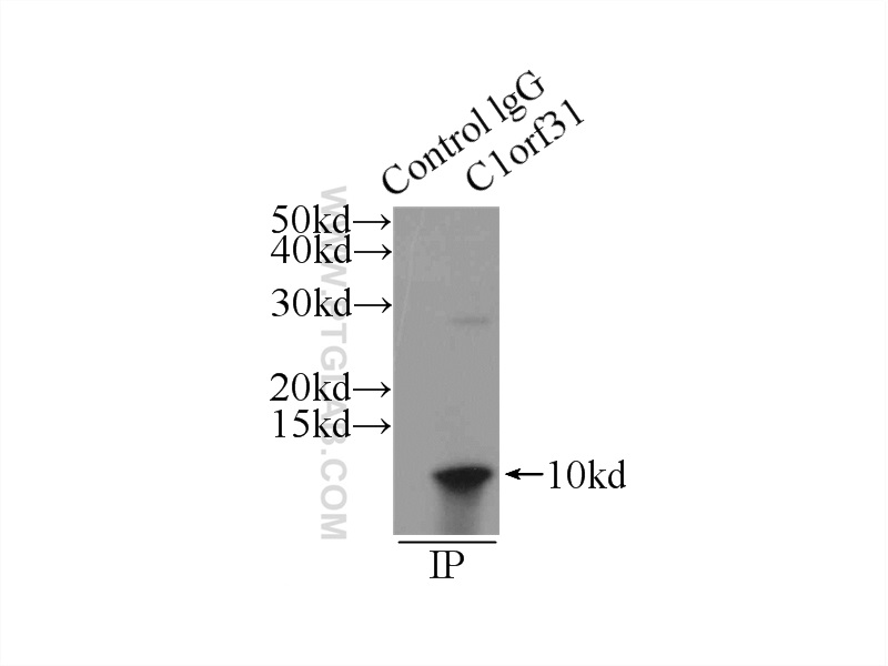 IP Result of anti-C1orf31 (IP:24209-1-AP, 4ug; Detection:24209-1-AP 1:500) with HEK-293 cells lysate 1760ug.