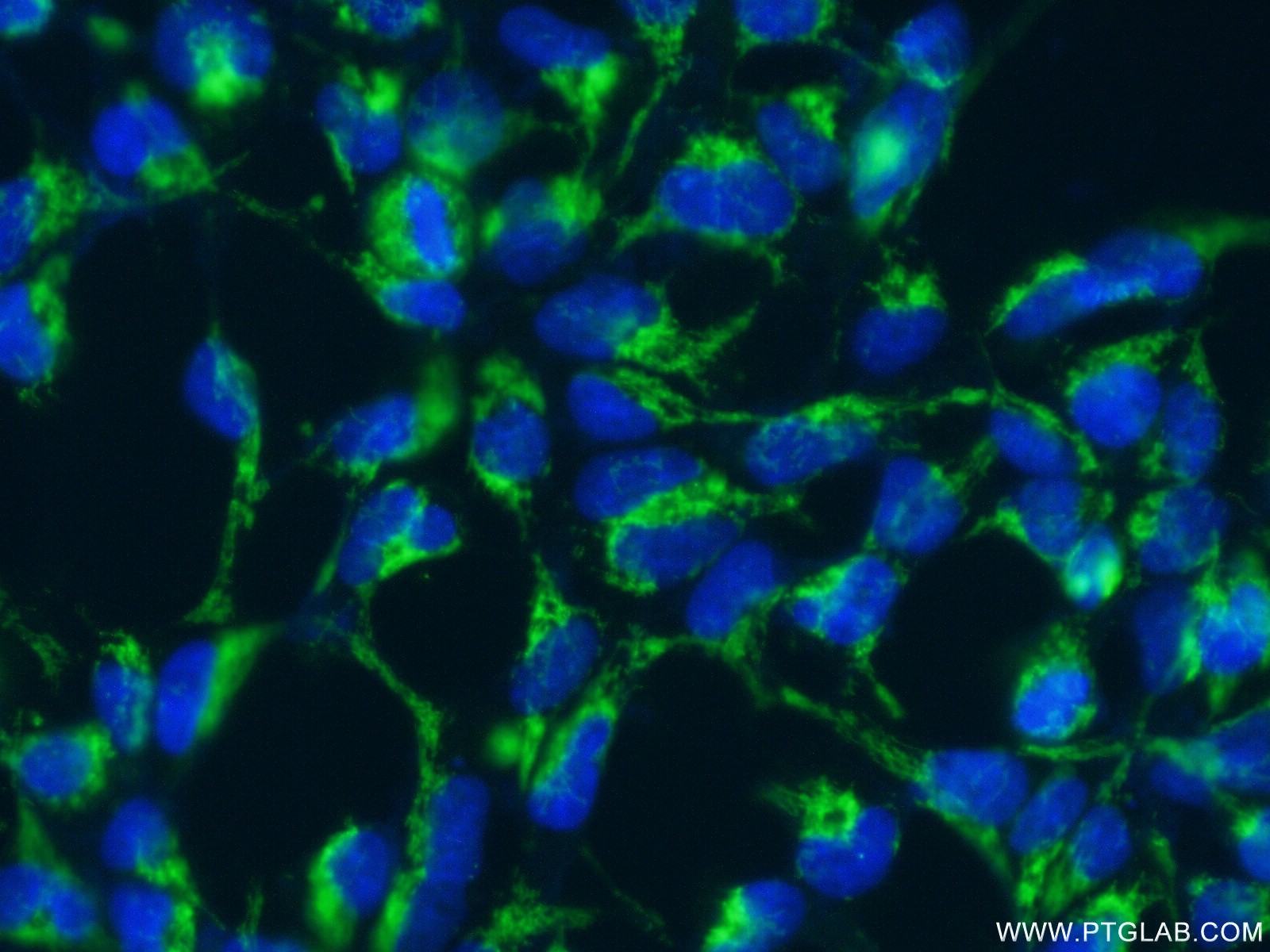 Immunofluorescent analysis of ( 4% PFA ) fixed HEK-293 cells using 24209-1-AP( C1orf31 Antibody) at dilution of 1:50 and Alexa Fluor 488-congugated AffiniPure Goat Anti-Rabbit IgG(H+L)