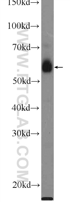 HeLa cells were subjected to SDS PAGE followed by western blot with 21031-1-AP( C1orf92 Antibody) at dilution of 1:300