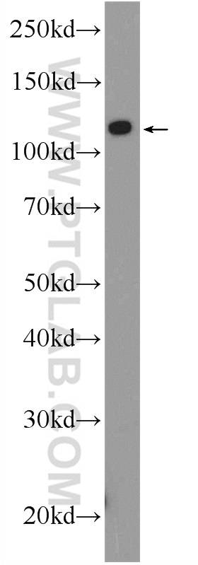 HeLa cells were subjected to SDS PAGE followed by western blot with 25832-1-AP( C21orf45 Antibody) at dilution of 1:300