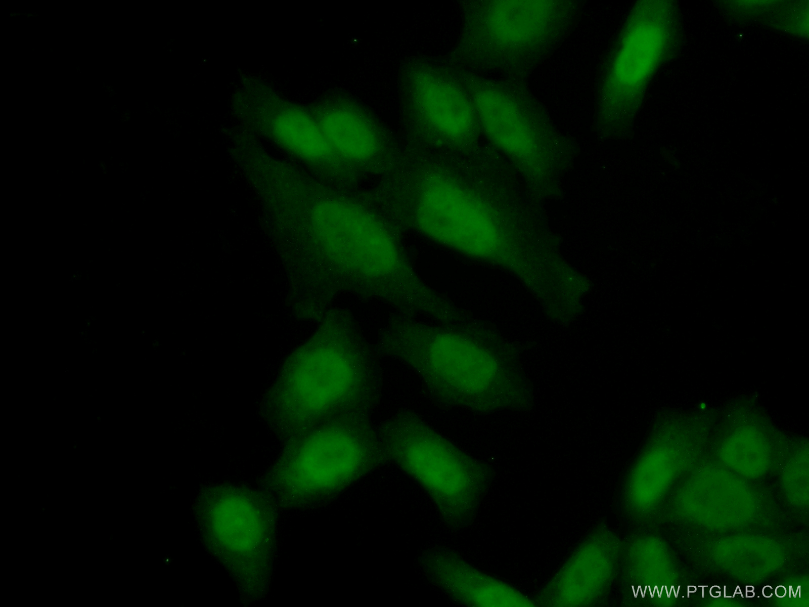Immunofluorescent analysis of ( 10% Formaldehyde ) fixed HeLa cells using 25832-1-AP( C21orf45 Antibody) at dilution of 1:50 and Alexa Fluor 488-congugated AffiniPure Goat Anti-Rabbit IgG(H+L)