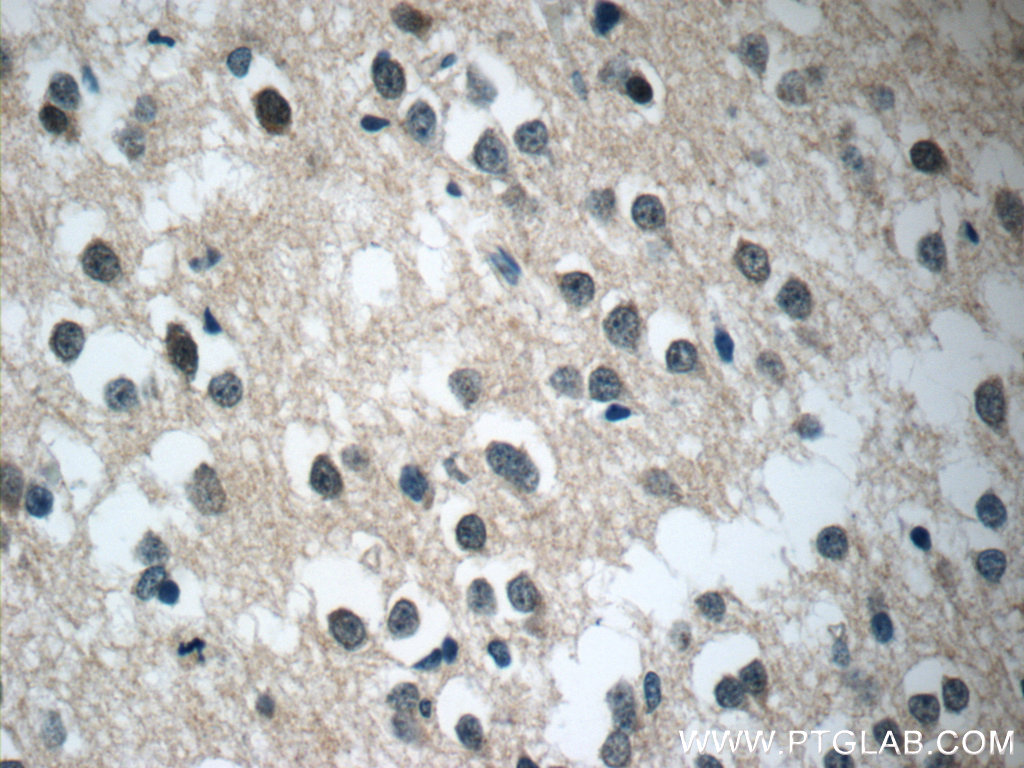 Immunohistochemistry of paraffin-embedded human brain tissue slide using 25024-1-AP( C21orf58 Antibody) at dilution of 1:50 (under 40x lens)