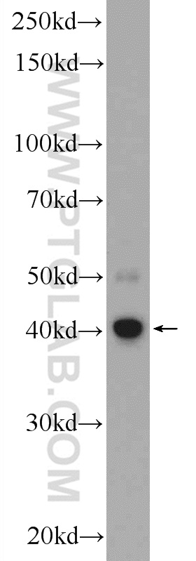 COLO 320 cells were subjected to SDS PAGE followed by western blot with 22046-1-AP( C5orf4 Antibody) at dilution of 1:300