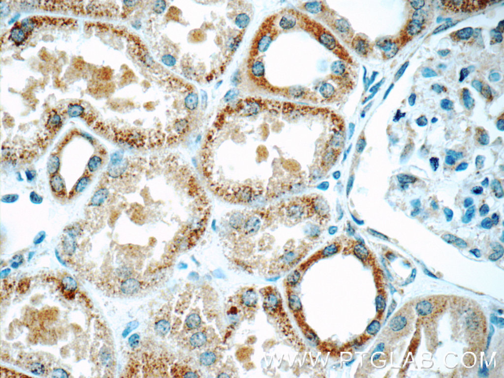 Immunohistochemistry of paraffin-embedded human kidney tissue slide using 22046-1-AP( C5orf4 Antibody) at dilution of 1:50 (under 40x lens)