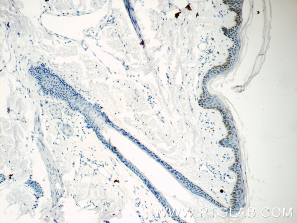 Immunohistochemistry of paraffin-embedded human skin tissue slide using 15076-1-AP( C7orf49 Antibody) at dilution of 1:25 (under 10x lens)