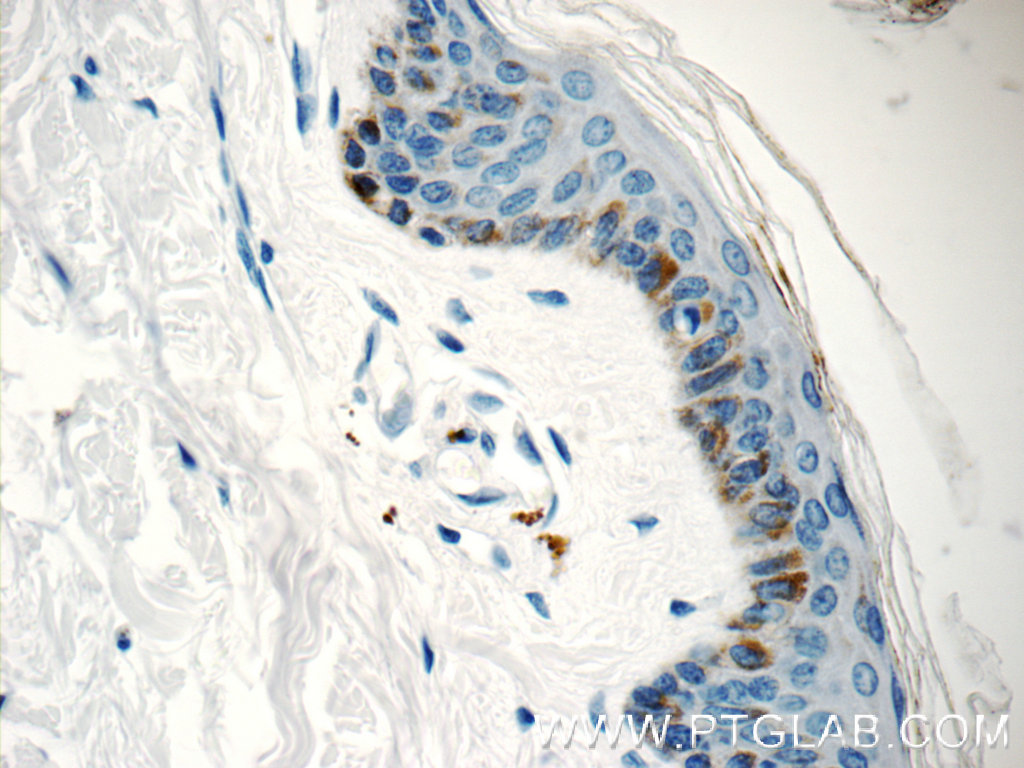 Immunohistochemistry of paraffin-embedded human skin tissue slide using 15076-1-AP( C7orf49 Antibody) at dilution of 1:25 (under 40x lens)