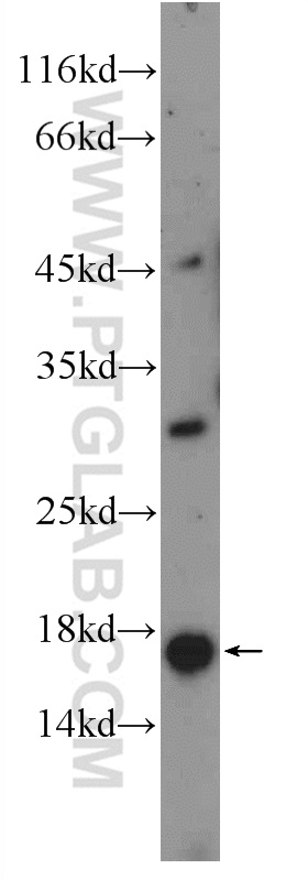 mouse testis tissue were subjected to SDS PAGE followed by western blot with 26034-1-AP( C9orf9 Antibody) at dilution of 1:300