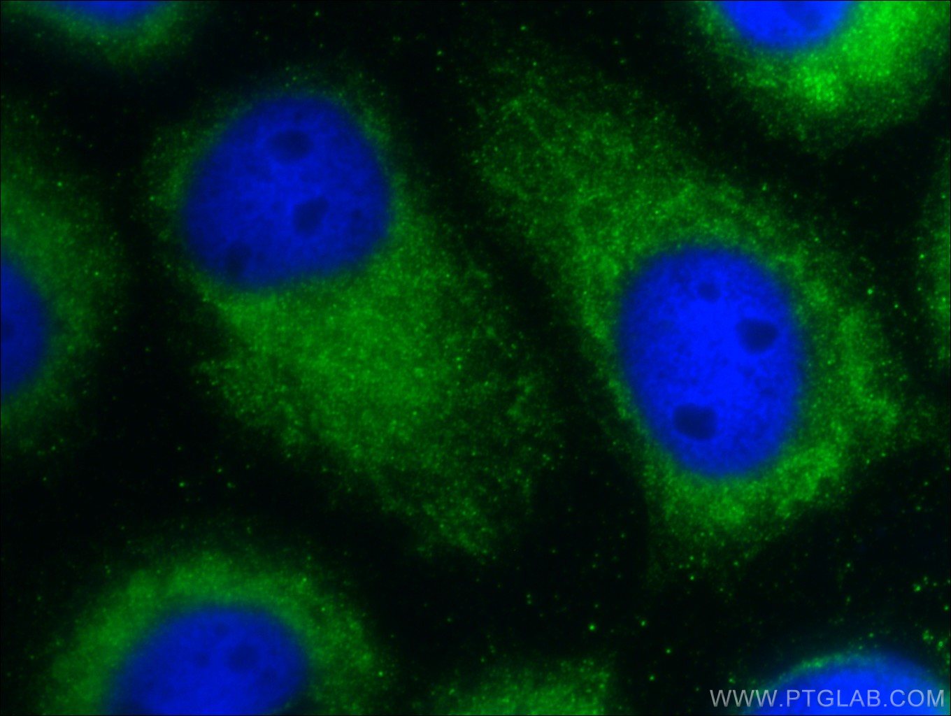 Immunofluorescent analysis of A431 cells using 26034-1-AP( C9orf9 Antibody) at dilution of 1:25 and Alexa Fluor 488-congugated AffiniPure Goat Anti-Rabbit IgG(H+L)