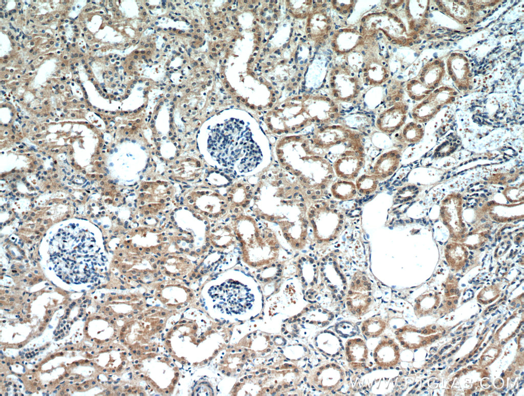 Immunohistochemical of paraffin-embedded human kidney using 21209-1-AP(CCDC25 antibody) at dilution of 1:50 (under 10x lens)