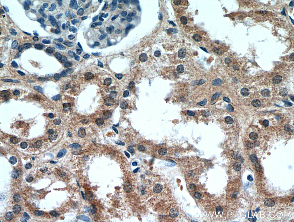 Immunohistochemical of paraffin-embedded human kidney using 21209-1-AP(CCDC25 antibody) at dilution of 1:50 (under 40x lens)