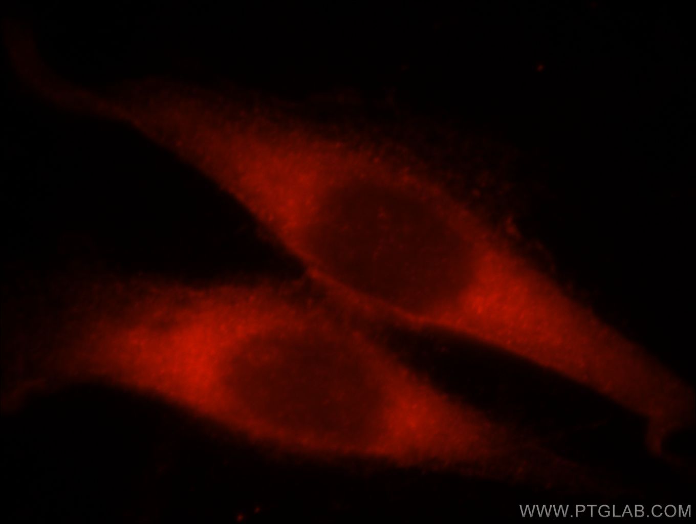 Immunofluorescent analysis of Hela cells, using CCDC25 antibody 21209-1-AP at 1:25 dilution and Rhodamine-labeled goat anti-rabbit IgG (red).