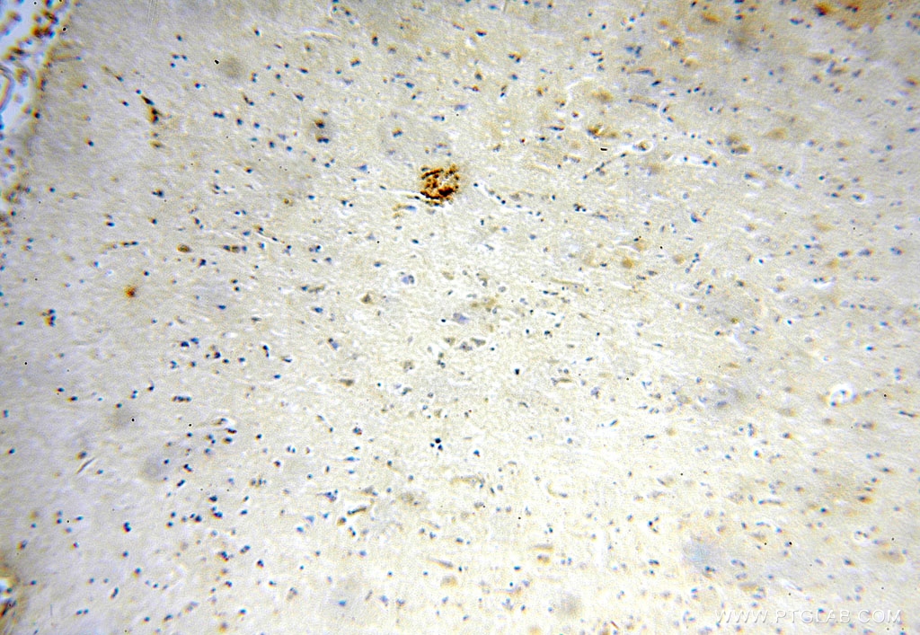 Immunohistochemical of paraffin-embedded human brain using 16791-1-AP(METTL5 antibody) at dilution of 1:100 (under 10x lens)