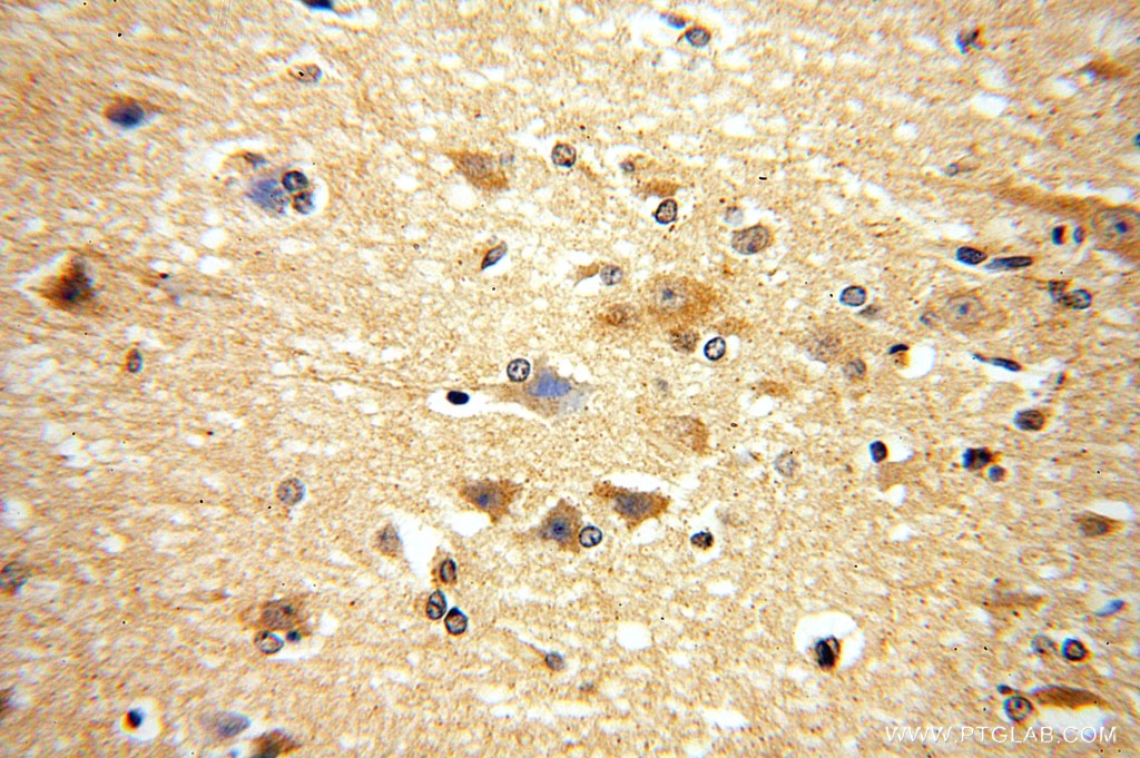 Immunohistochemical of paraffin-embedded human brain using 16791-1-AP(METTL5 antibody) at dilution of 1:100 (under 40x lens)