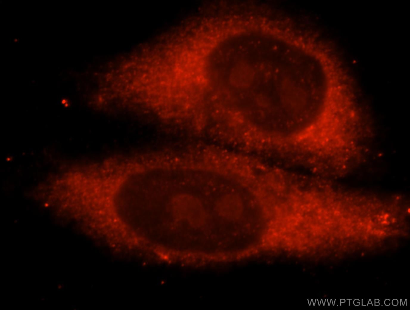 Immunofluorescent analysis of HepG2 cells, using METTL5 antibody 16791-1-AP at 1:25 dilution and Rhodamine-labeled goat anti-rabbit IgG (red).