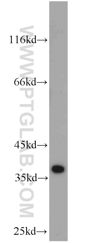 Jurkat cells were subjected to SDS PAGE followed by western blot with 23178-1-AP(MGME1 antibody) at dilution of 1:1000