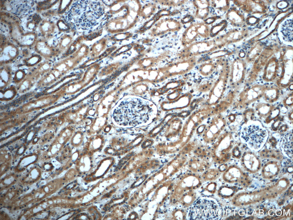 Immunohistochemistry of paraffin-embedded human kidney slide using 23178-1-AP( MGME1 Antibody) at dilution of 1:50 (under 10x lens)