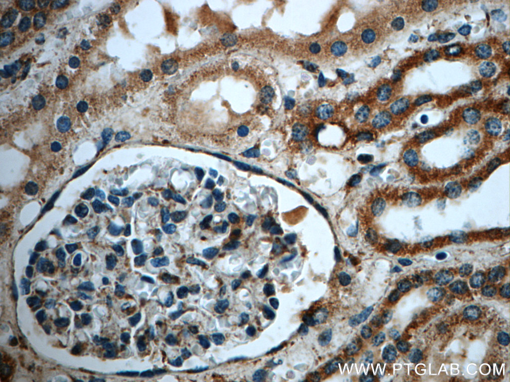 Immunohistochemistry of paraffin-embedded human kidney slide using 23178-1-AP( MGME1 Antibody) at dilution of 1:50 (under 40x lens)