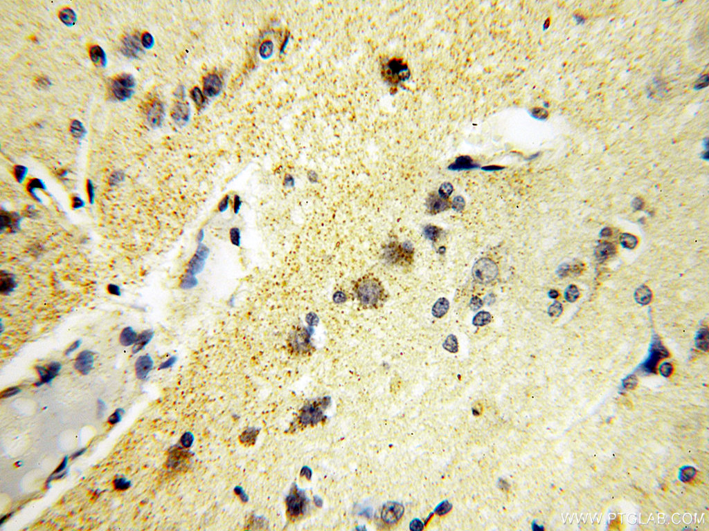 Immunohistochemical of paraffin-embedded human brain using 13965-1-AP(MICAL2 antibody) at dilution of 1:100 (under 40x lens)