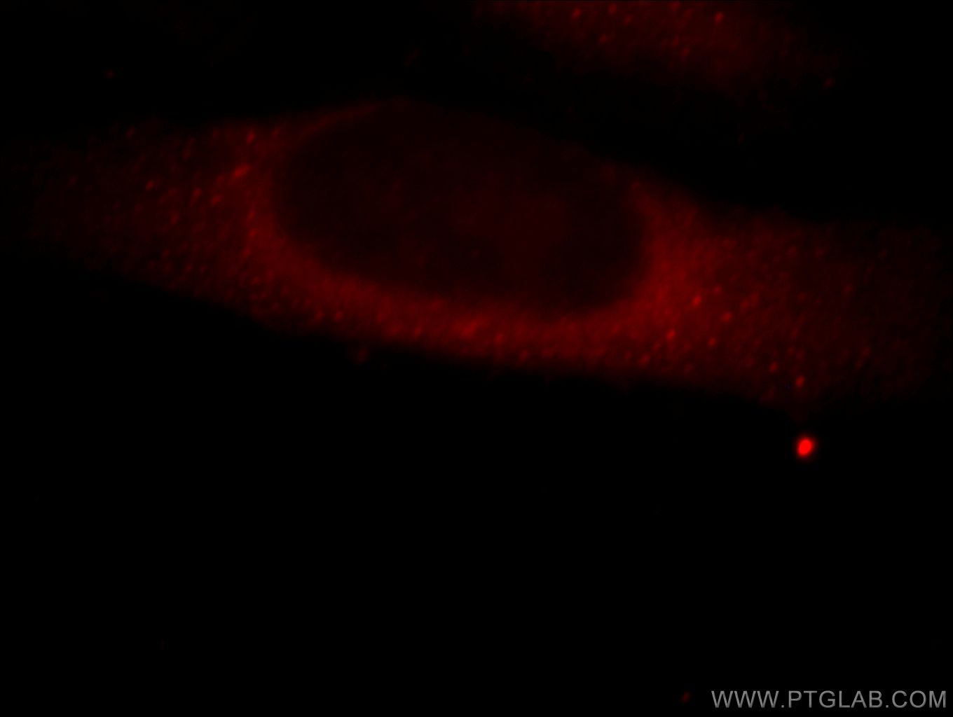 Immunofluorescent analysis of HepG2 cells, using MICAL2 antibody 13965-1-AP at 1:25 dilution and Rhodamine-labeled goat anti-rabbit IgG (red).