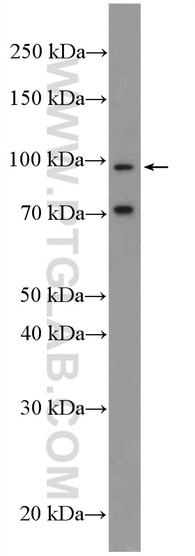 PC-3 cells were subjected to SDS PAGE followed by western blot with 13965-1-AP( MICAL2 Antibody) at dilution of 1:300