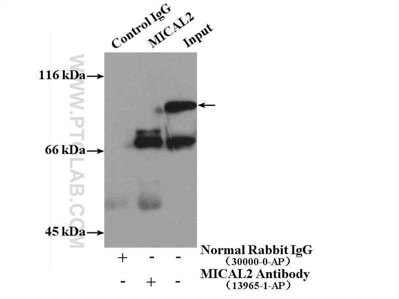 IP Result of anti-MICAL2 (IP:13965-1-AP, 5ug; Detection:13965-1-AP 1:300) with PC-3 cells lysate 5000ug.