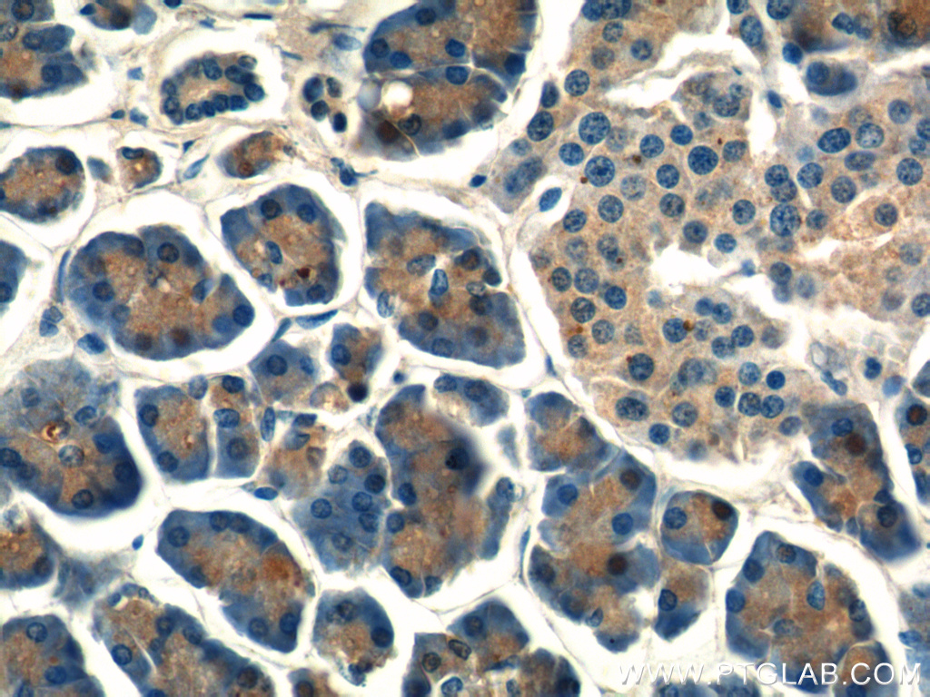 Immunohistochemistry of paraffin-embedded human pancreas tissue slide using 15040-1-AP( MRPL14 Antibody) at dilution of 1:50 (under 40x lens)
