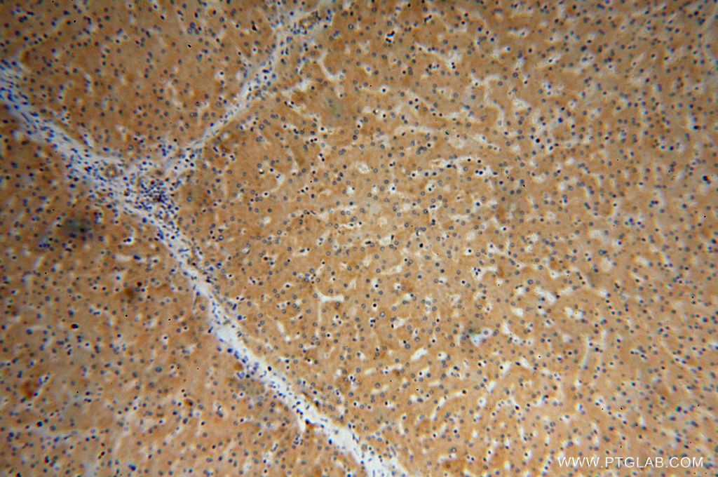 Immunohistochemical of paraffin-embedded human liver using 15913-1-AP(MRPL38 antibody) at dilution of 1:100 (under 10x lens)