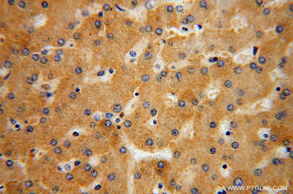 Immunohistochemical of paraffin-embedded human liver using 15913-1-AP(MRPL38 antibody) at dilution of 1:100 (under 40x lens)