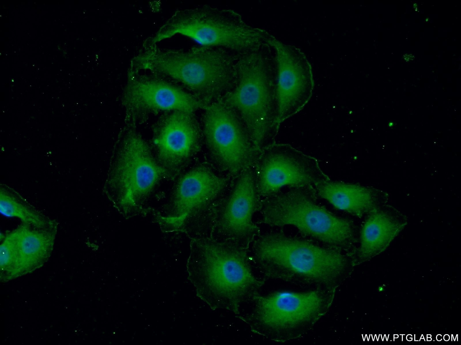Immunofluorescent analysis of SH-SY5Y cells using 24565-1-AP( MYO10 Antibody) at dilution of 1:50 and Alexa Fluor 488-congugated AffiniPure Goat Anti-Rabbit IgG(H+L)