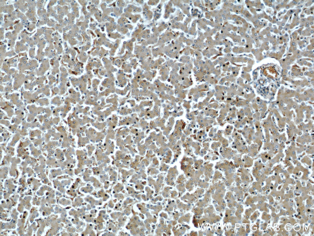 Immunohistochemical of paraffin-embedded human liver using 14794-1-AP(NDUFB8 antibody) at dilution of 1:50 (under 10x lens)