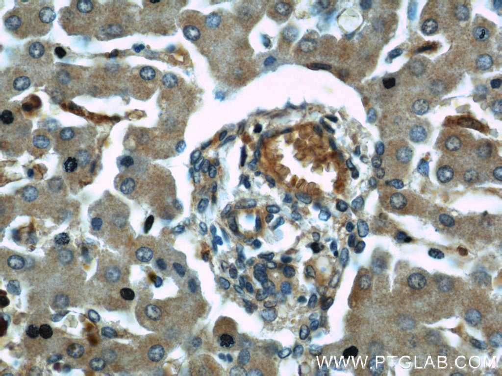 Immunohistochemical of paraffin-embedded human liver using 14794-1-AP(NDUFB8 antibody) at dilution of 1:50 (under 40x lens)