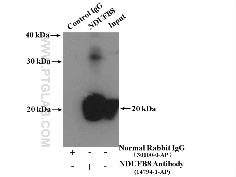 IP Result of anti-NDUFB8 (IP:14794-1-AP, 4ug; Detection:14794-1-AP 1:1000) with mouse liver tissue lysate 4000ug.