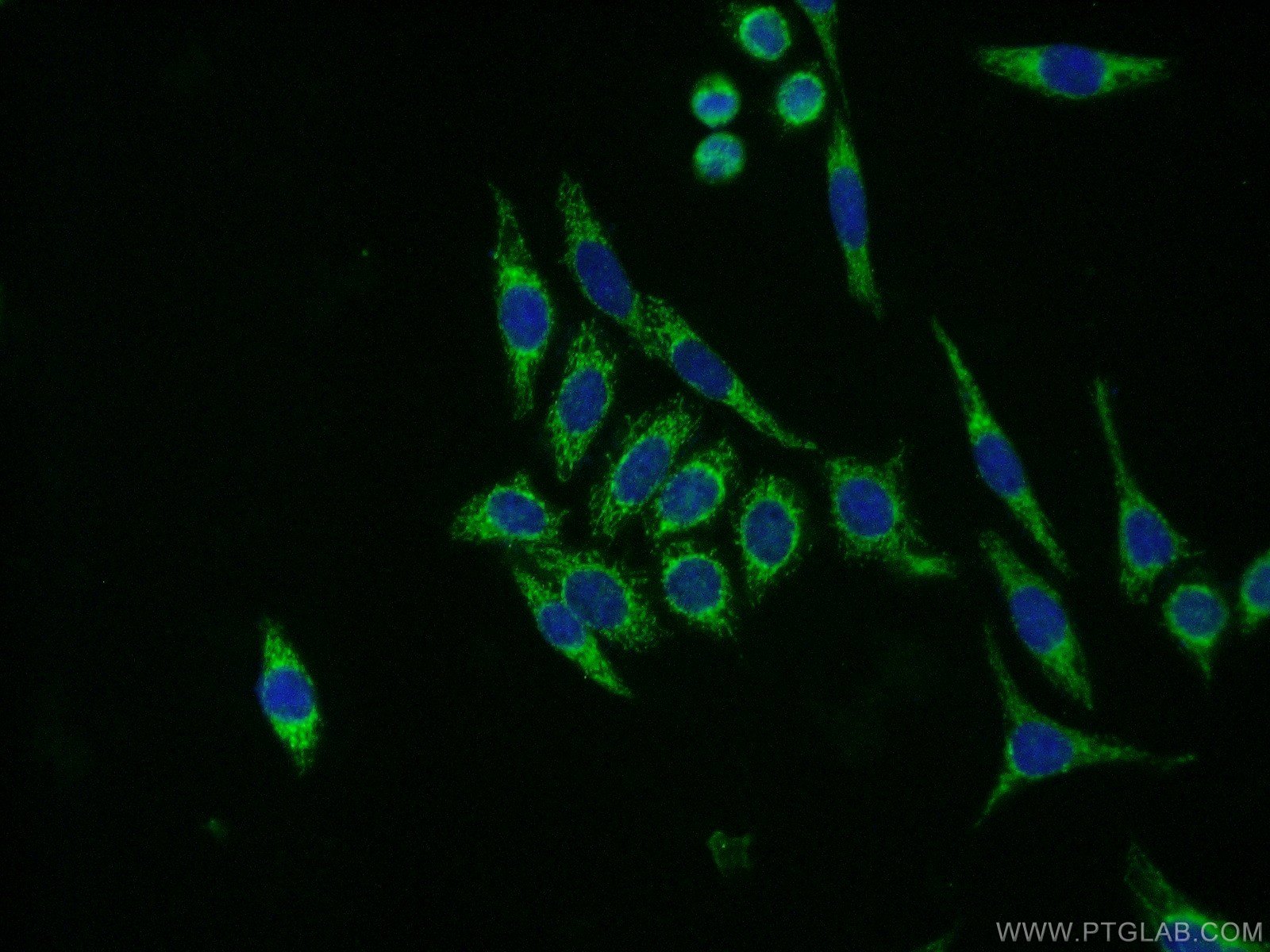Immunofluorescent analysis of ( -20℃ Ethanol ) fixed HeLa cells using 14794-1-AP( NDUFB8 Antibody) at dilution of 1:50 and Alexa Fluor 488-congugated AffiniPure Goat Anti-Rabbit IgG(H+L)